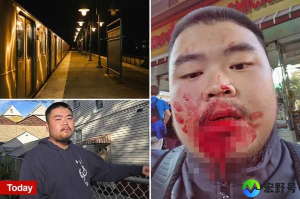 寿司大厨在离开纽约地铁站时被打晕：“感觉就像被刀捅了一样”