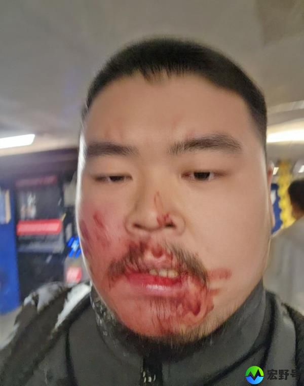 10/15/24  Ferdianto Suwandi (pictured) was punched by a total stranger while exiting the number 7 subway train at the Woodside stop around 4 PM last Friday, October 11, 2024.