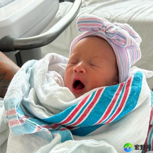 One of the twins is pictured giving a big yawn.