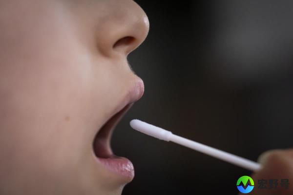 Novacyt与政府就Covid-19检测试剂盒索赔达成和解